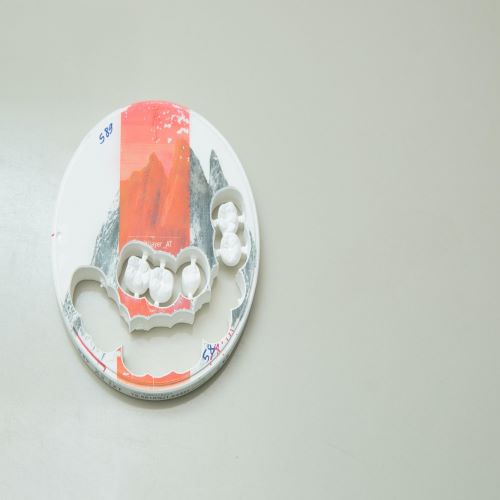 تعرف معنا على أهم أنواع الغرسات المستخدمة في زرع الأسنان